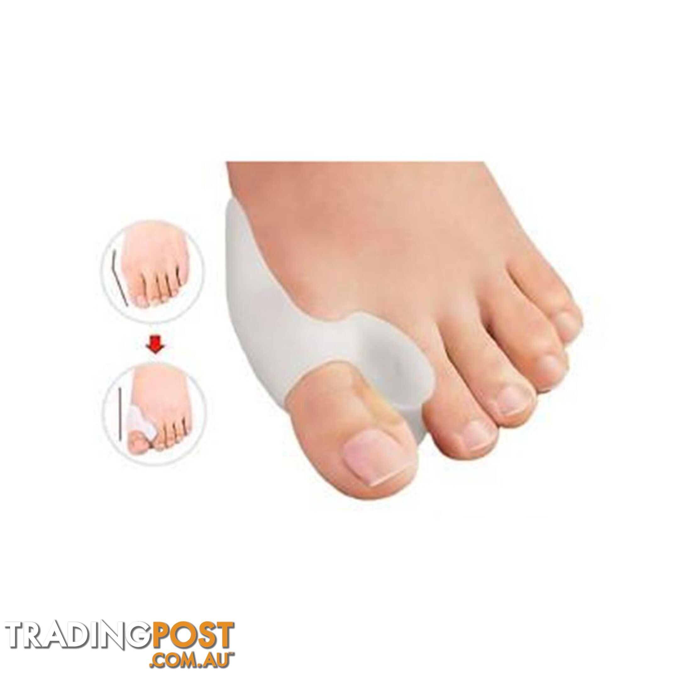 Silicone Toe Alignment Support - Unbranded - 7427005873478