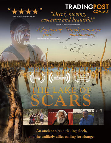 Lake of Scars, The (Lifetime Access)